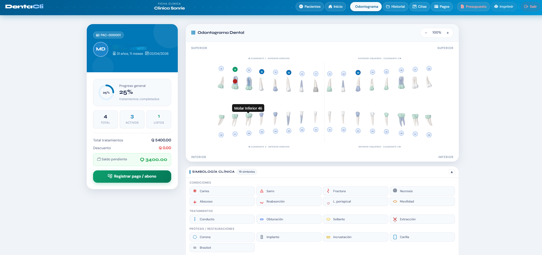 Odontograma dental DentaCli